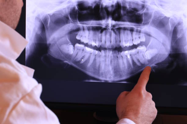 Best Chipped Tooth Repair Near Me  in Wrightsboro, NC